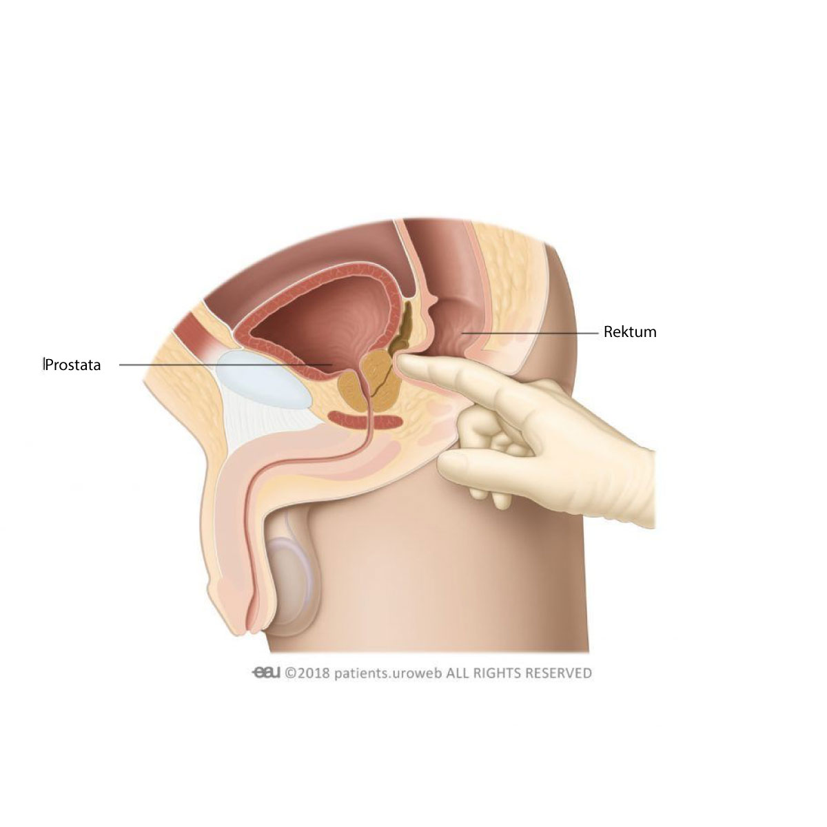 Diagnose von Harninkontinenz