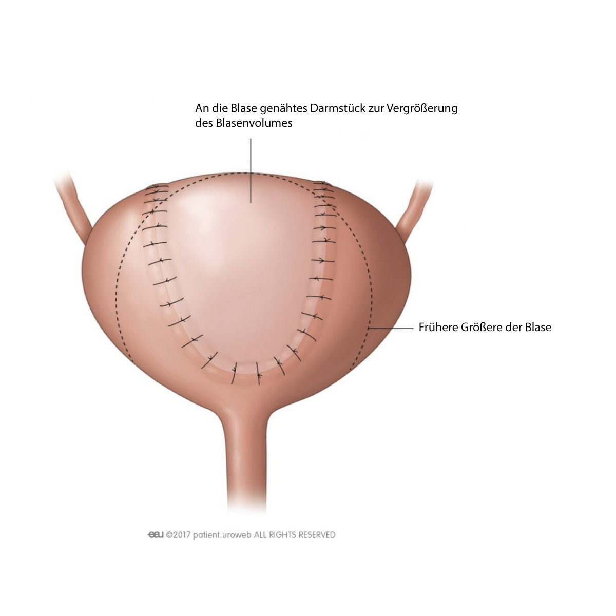 Behandlungsm&ouml;glichkeiten f&uuml;r Harninkontinenz